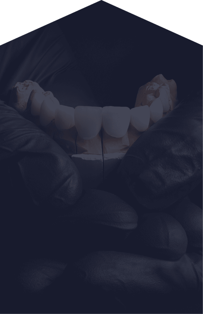 Treatment - Rochester Lodge Dental