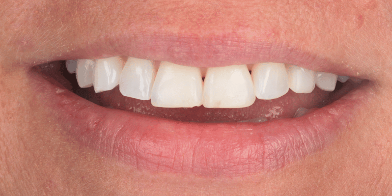 Before - Rochester Lodge Dental