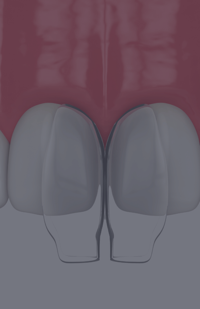 Treatment - Rochester Lodge Dental