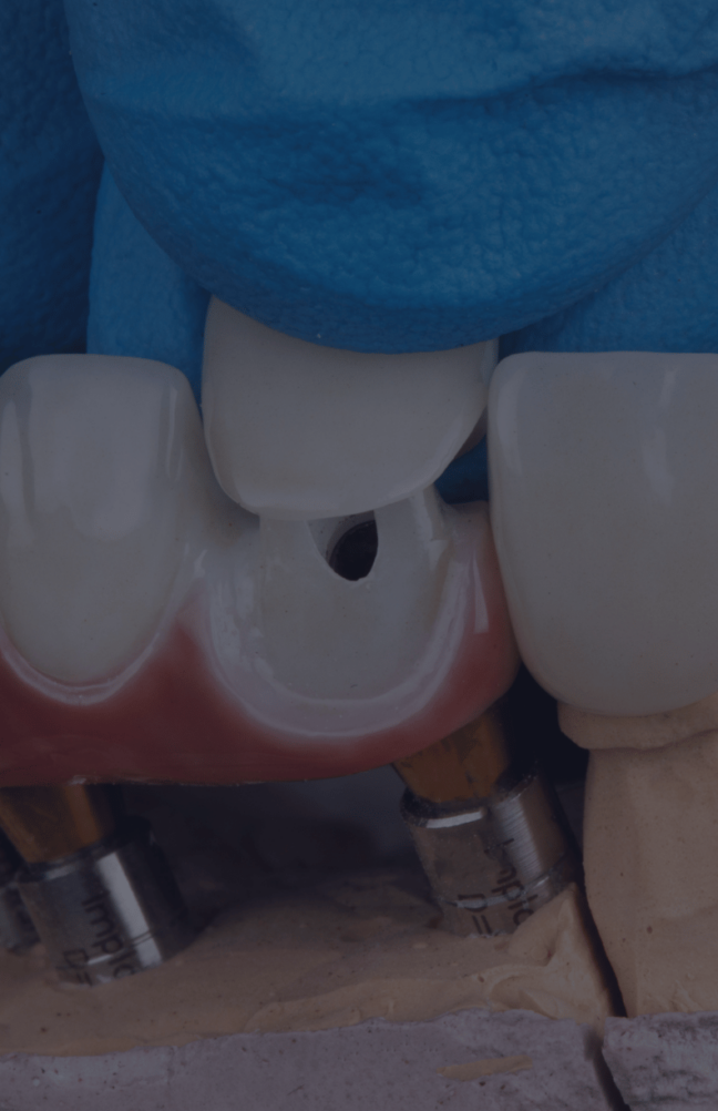 Treatment - Rochester Lodge Dental